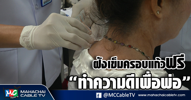 vk ฝังเข็ม 4